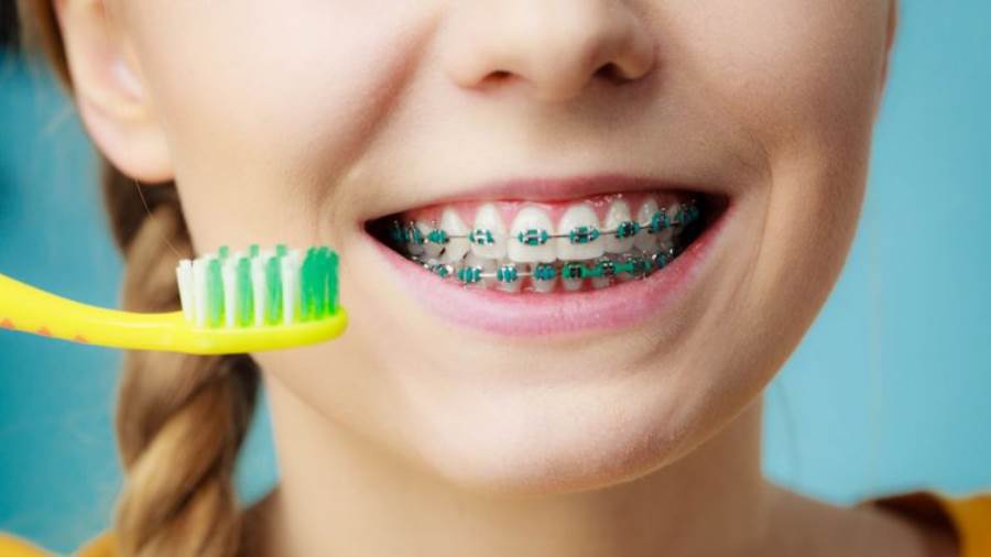 ما هي اضرار تقويم الاسنان موقع مصادر