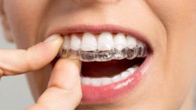 تقويم الاسنان وانواعه وكيفية العناية بالاسنان