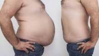 شفط الدهون من البطن بدون جراحة